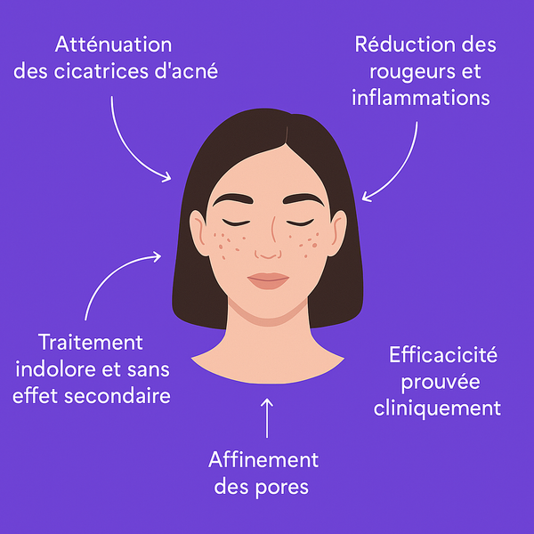 MASQUE DE BEAUTÉ